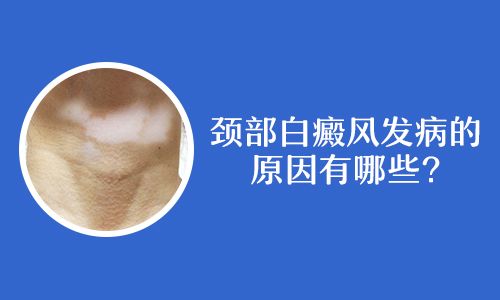 诊断治疗-手部的白癜风到了晚期怎么治呢-